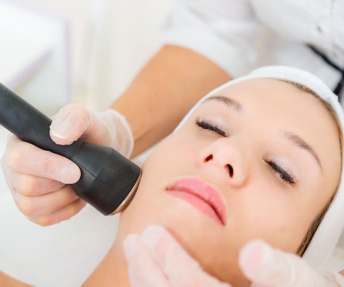 How lasers can fix your skin | Now To Love
