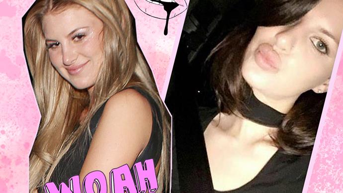 Has Briana Jungwirth had her lips done?