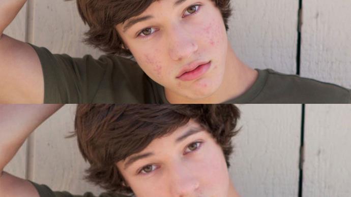 Cameron Dallas used to photoshop his acne out of photos