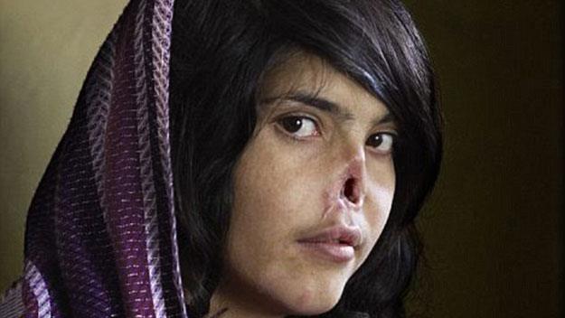 Woman mutilated by Taliban husband gets her face rebuilt