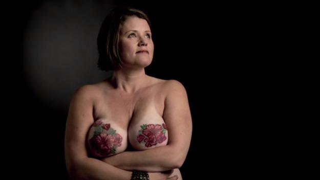 Women tattoos breasts to cover cancer scars 