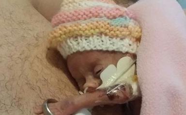 Premature baby fits wedding ring on arm