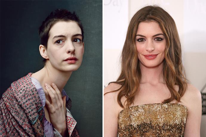 Anne Hathaway nabbed an Oscar after she shaved her head AND dropped 15 kilos for <em>Les Miserables</em>. Girls committed.