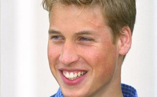 Prince William Got A Real-Life Harry Potter Scar In The Most English Way