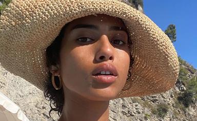 How To Treat And Prevent Hyperpigmentation In Summer, According To An Expert