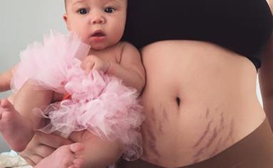 This mum is celebrating her post-baby stretch marks in the most beautiful way