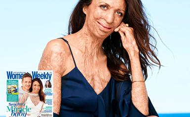 How the thought of a baby kept Turia Pitt going