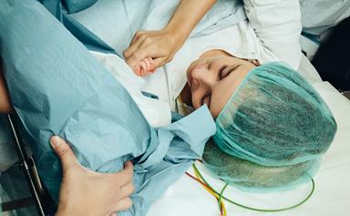 5 things everyone NEEDS to know about caesareans