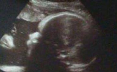 Can you see why everyone's so obsessed with this sonogram?