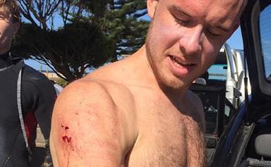 Surfer who punched shark in the face says he has Mick Fanning to thank for his escape