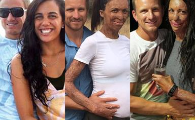 In pictures: New parents Turia Pitt and Michael Hoskin's love story