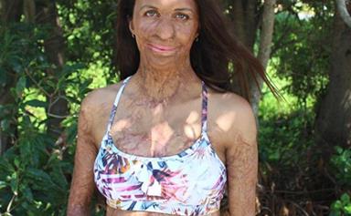 “The sound of his cry filled the room – he was perfect!” Turia Pitt’s VERY DETAILED account of her birth