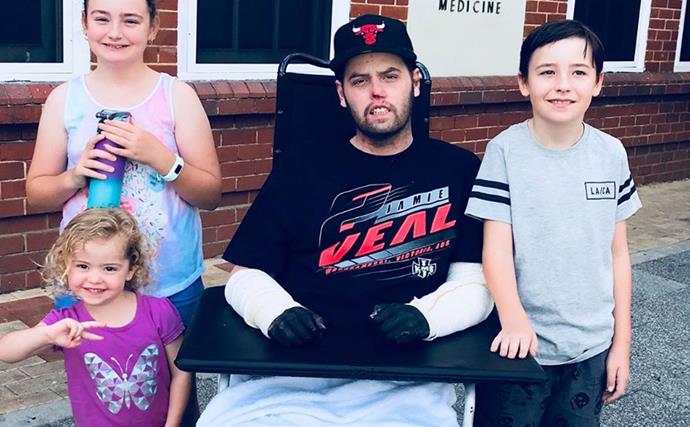 Meningococcal warning: Perth father's message to others after losing hands and legs to meningococcal