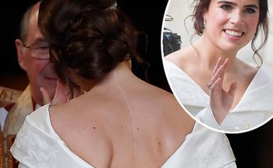 Princess Eugenie opens up about her struggle with scoliosis