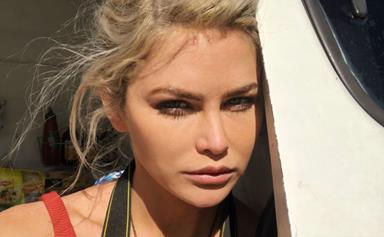 Bachelor In Paradise star Megan Marx's serious warning about cosmetic surgery after botched job
