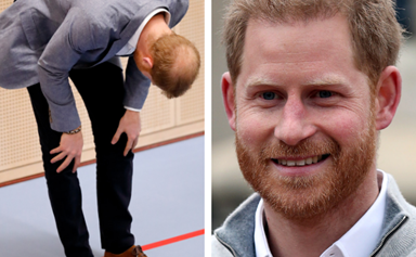 Seriously, poor Prince Harry's bald patch keeps getting bigger and bigger