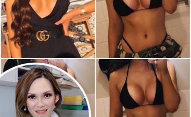 OPEN LETTER: Plastic surgeon defends dramatic before-and-after transformation photos