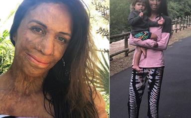 Turia Pitt speaks candidly about enjoying the "small moments" rather than milestones with her son