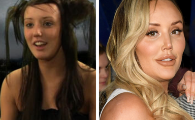 Charlotte Crosby's plastic surgery transformation in photos