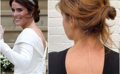 Princess Eugenie shows her scoliosis scar in her most raw and honest Instagram post yet