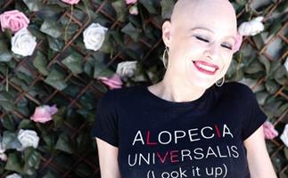 REAL LIFE: Meet the brave mum on a mission to empower those with alopecia