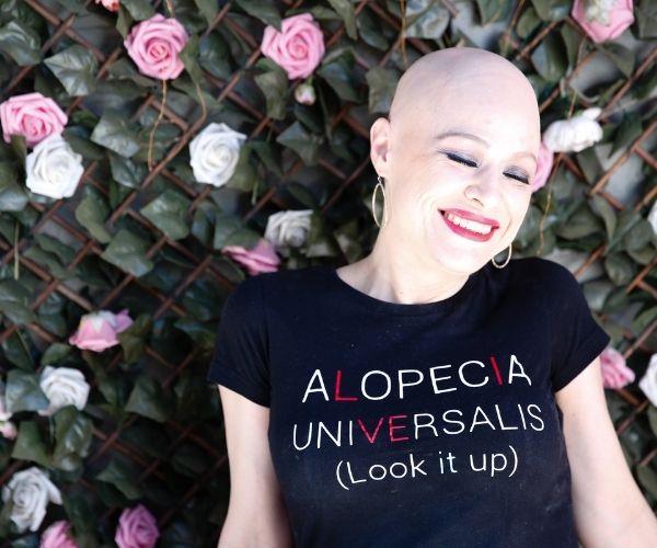 REAL LIFE: Meet the brave mum on a mission to empower those with alopecia