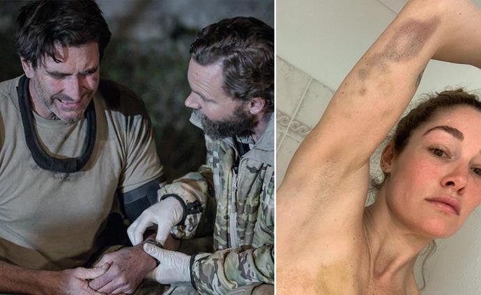 The most brutal injuries in SAS Australia history prove the show takes a serious toll on its stars
