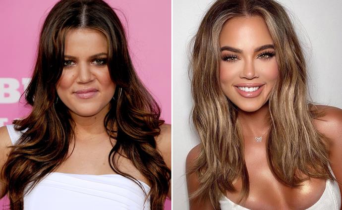 The truth behind Khloe Kardashian's unreal beauty evolution, from being the "ugly" sister to breaking the internet