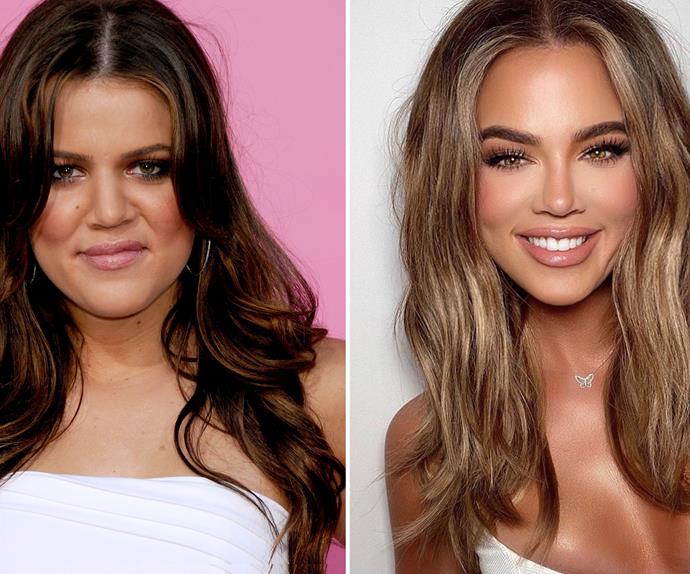The truth behind Khloe Kardashian's unreal beauty evolution, from being the "ugly" sister to breaking the internet