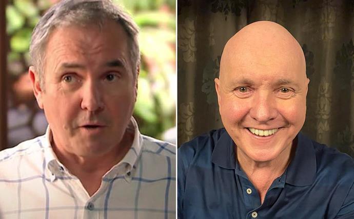 How Neighbours veteran Alan Fletcher is encouraging others with Alopecia to be unfazed by hair loss