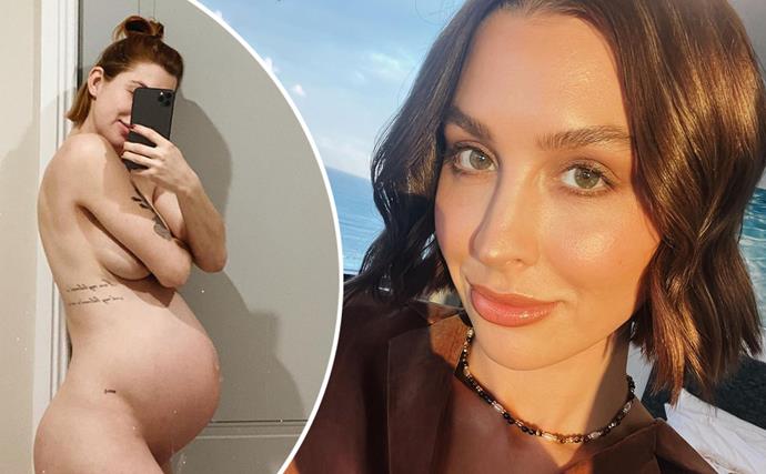 Alex Nation’s plastic surgery confession after mum body struggles: “I was incredibly insecure about them!”