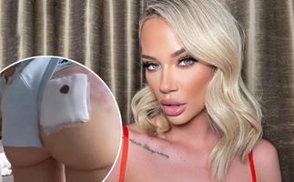MAFS’ Jessika Power shocks fans with graphic videos of latest plastic surgery transformation