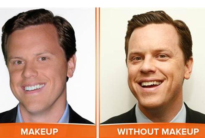 "I have a forehead you could show a drive-in movie on," Willie Geist, 38, said.