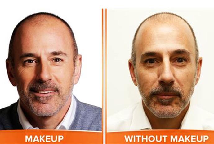 Matt Lauer, 56, on getting older: "The hair thing bothered me".