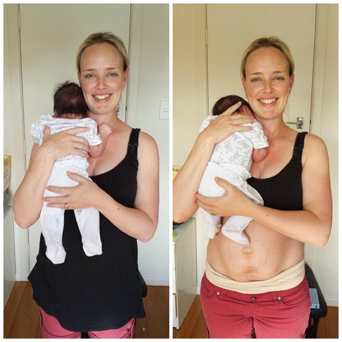 One Mothers Story My Real Post-Baby Body  Australian -2542