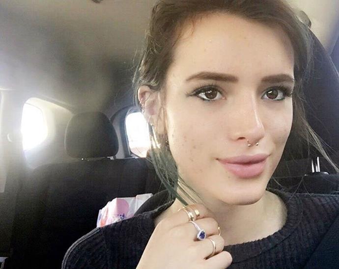 **Bella Thorne:**
When she on Instagram, "Real skin alert it's no secret I struggle w acne. Sometimes it's clear and sometimes it's just not. I'm very self conscious and constantly feeling bad about myself. BUT I shouldn't feel bad. It is normal to have acne. EVERY1 doesIt's only our society and social media outlets like this one that tells us we have to have "perfect skin" to be considered socially acceptable. I'm going to show my skin for what is it and own it. No matter what any1 says. #ownit #beyou #acne #purebeauty #nofilter.