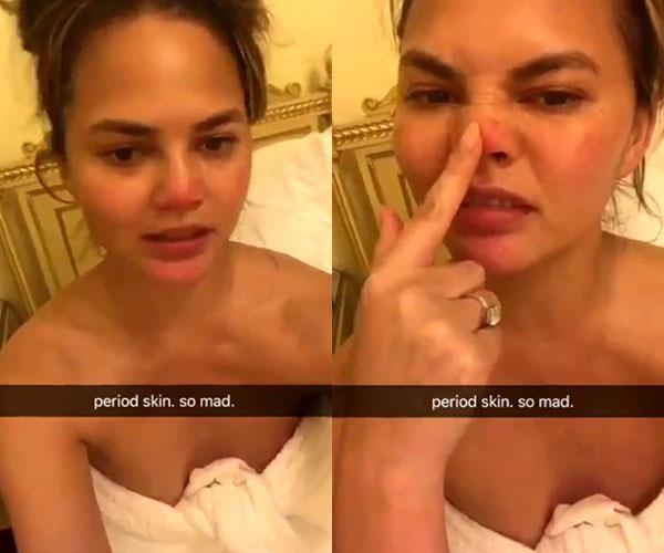 **Chrissy Teigen:** For many women, PMS is less about feeling emotional and more about acne. In her signature real style, Chrissy Teigen posted a video to Twitter recently, to show how her skin changes during her period. Teigen has a few blemishes on her nose and chin. GURL, we can relate
