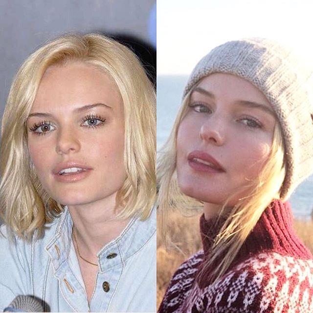 ***Kate Bosworth*** <br><br>
"I have seen the 10 yr challenge everywhere and it got me to thinking—what is the actual challenge? To look the same? Better? Different? <br><br>
For me, it was to look back on a human in her 20's (left photo) wide-eyed, & living in a ton of fear because I felt no control over my life. I had neither the experience nor the tools to really understand myself. I started out in this industry at 14 years old—quite by accident. Anyone who follows me from middle school or high school will tell you—I was (and still am) a normal kid from a small town. But I love telling stories and working in a community who literally work their asses off right up until the moment someone yells "ACTION!" in an attempt to make magic (which is what I believe great cinema is—magic). But that girl on the left was not prepared for the wacky / cruel / overwhelming attention fame can bring, and I truly did not know how to process any of it. I internalized the fear, did not communicate much, and certainly did not voice my extreme vulnerability, as I felt it was a weakness. Regardless of the road travelled, the 20's can be weird and confusing. You are developing. This requires patience and self-care: both qualities I admittedly did not have at the time. I kind of barreled through the decade in an attempt to fake looking cool & confident (I wasn't) + feel less pain. <br><br>
Ok, so I am now 36—and I often get asked from journalists (🙄) how do I feel about ageing (as if this is a bad word—we need to work to change this perspective, but that's a different post). How do I feel about evolving from fear and learning to live through love? AWESOME. Aware there are always growing pains in life, but what a miracle to be alive. The woman on the right feels grateful to create art in different ways, finds strength in vulnerability - and beyond anything else—she knows love is everything. Also, "cool & confident" to me now is goofy, kind, and honest. <br><br>
So... Go easy on your hearts now 20 yr olds—you're not supposed to have it figured out. Find mentors, lean on those you trust who have more life experience. ❤️ Thanks for this challenge, here's to the next 10. (I hear the 40's are even better ;)" <br><br>
*Image: [@katebosworth](https://www.instagram.com/p/BstEQK5n8WN/|target="_blank"|rel="nofollow")*