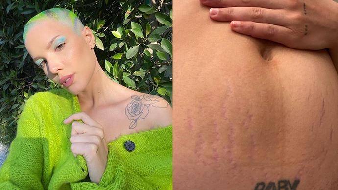**Halsey**
<br><br>
The 26-year-old musician shared an incredibly sweet look into life as a new mother, after giving birth to her child, Ender. "Well….this is what it look like" Halsey captioned the [Instagram post](https://www.instagram.com/p/CSS5EYQrb4R/?utm_source=ig_embed&ig_rid=3eb56373-c688-418b-a1b2-c70a69a2f9db|target="_blank"|rel="nofollow"). Showing off their postpartum stretch marks, the unedited snap of Halsey's stomach attracted fans' attention, seeing many praising them for breaking down the unrealistic, damaging beauty ideals, people face post-pregnancy.