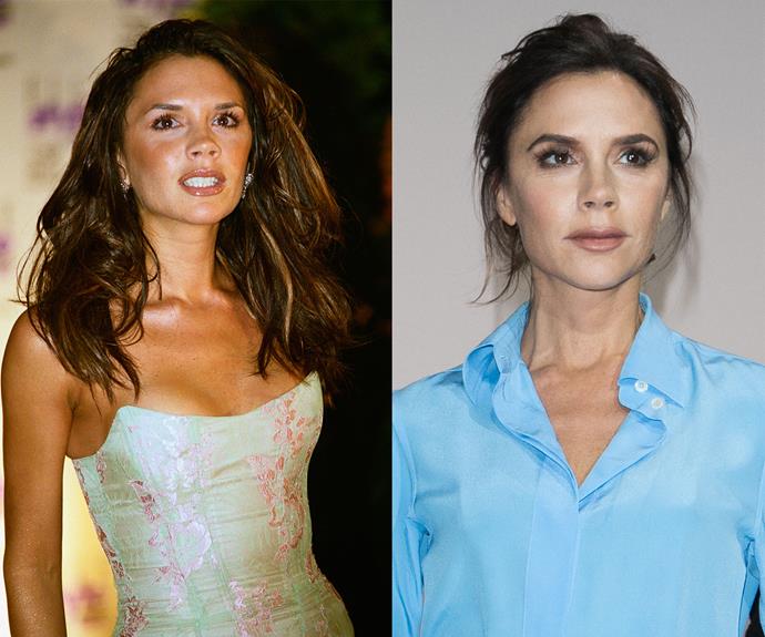 Victoria Beckham had breast augmentation surgery in 1999 after giving birth to her first son, Brooklyn, but told *Allure* in 2014: "I don't have them anymore [...] They got removed." Her once DDs are now a B.