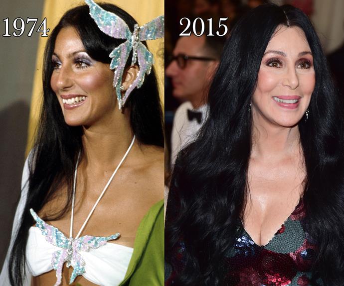 Cher told *People* magazine in 90s, “I’ve had my breasts done, but my breast operations were a nightmare. They were really botched in every way. If anything, they were worse after than before.”
