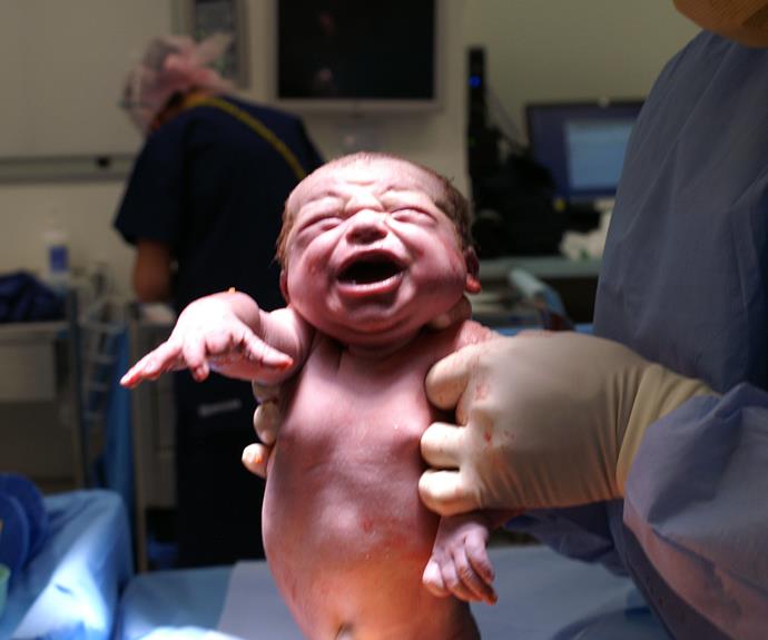 After 14 hours of labour, Erin had no choice but to have a C-section.