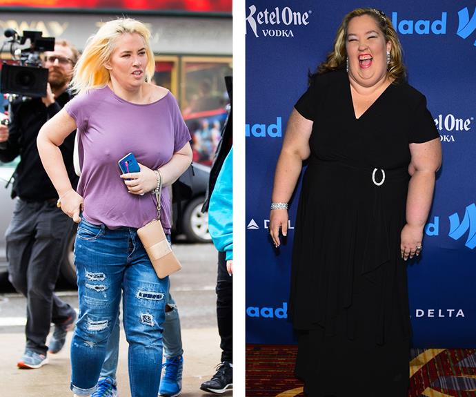 According to [*PEOPLE*](http://www.nowtolove.com.au/health/fitness/best-celeb-body-transformations-of-2016-33044|target="_blank"|rel=”nofollow”), after getting gastric-band surgery and adhering to a rigorous workout routine, reality TV mum [Mama June](http://www.nowtolove.com.au/health/body/mama-june-revenge-body-36512|target="_blank") managed to lose a staggering 136kg in less than 12 months! Although, what some might not know about losing this much weight is the painful surgeries it takes to remove all of the excess skin left behind...