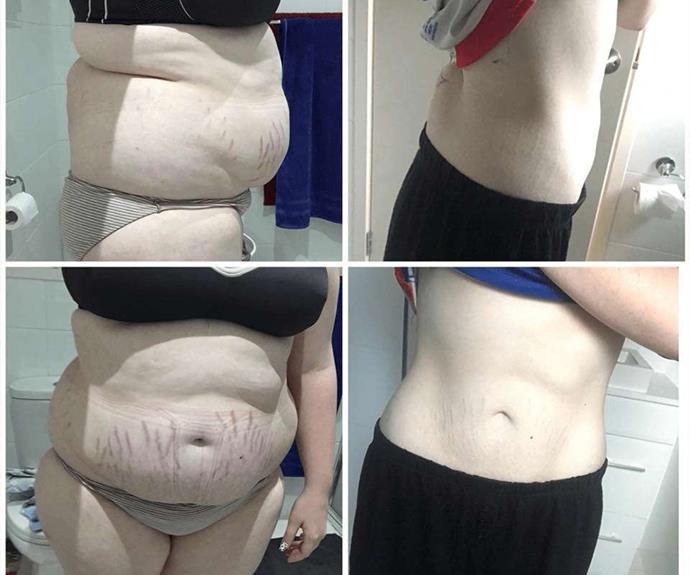 Nikita has lost an impressive 39kg with [The Healthy Mummy](https://www.healthymummy.com/|target="_blank"|rel="nofollow"). 