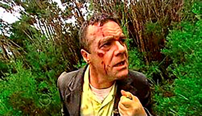 **33) PAUL ROBINSON LOSES A LEG**
<br><br>
In 2005, Paul Robinson (Stefan Dennis, inset) had his leg amputated after an infection set in when he fell from a cliff while trying to escape some crims. 
<br><br>
Over the years, his limp has noticeably decreased…