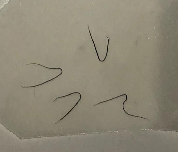 What Stephanie's lashes looked like when they fell out after treatment, which happened at a beauty salon in Sydney's south.  *(Image: Supplied)*