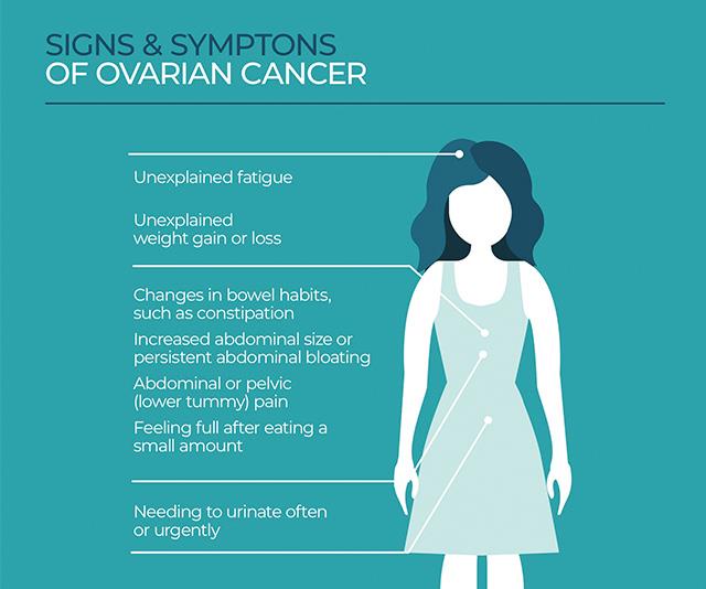 ovarian cancer uti)
