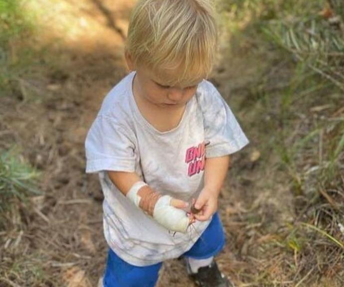 Turia explained how her son bravely faced his injury on her Instagram.
<br><br>
"Rahiti cut his hand on an oyster a few weeks ago. He needed surgery to make sure it was cleaned out and stitched up properly BUT he is all good and seems completely unperturbed by all the fuss and is out bushwalking /picking up sticks /investigating bushes like a seasoned pro," she revealed.