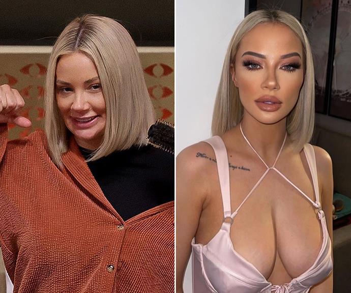 **Jessika Power, Big Brother VIP**
<br><br>
"I've had some injectables done to my face… I had fat sucked outside of my thighs and injected into my boobs," Jess revealed during her time on *BB*. But has she had more work done since? We'll let you decide for yourself.