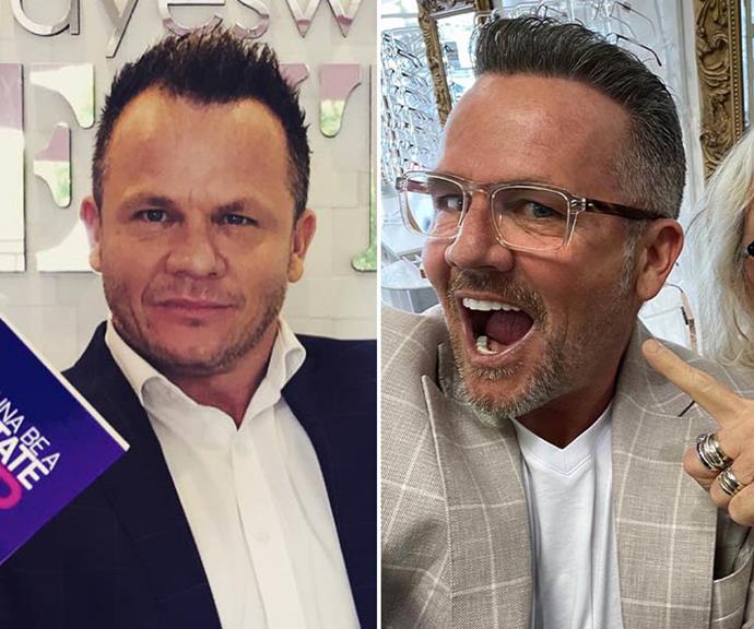 **Daniel Hayes, Big Brother VIP** <br><br>
His transformation came before he ever set foot on the show, but it wasn't until he joined the BB cast that he revealed exactly how much work he'd had done. "I've had my hair, bolt on teeth, bottom veneers, a bit of filler and just Botox," he confessed, adding that the procedures cost him around $140,000 all up.